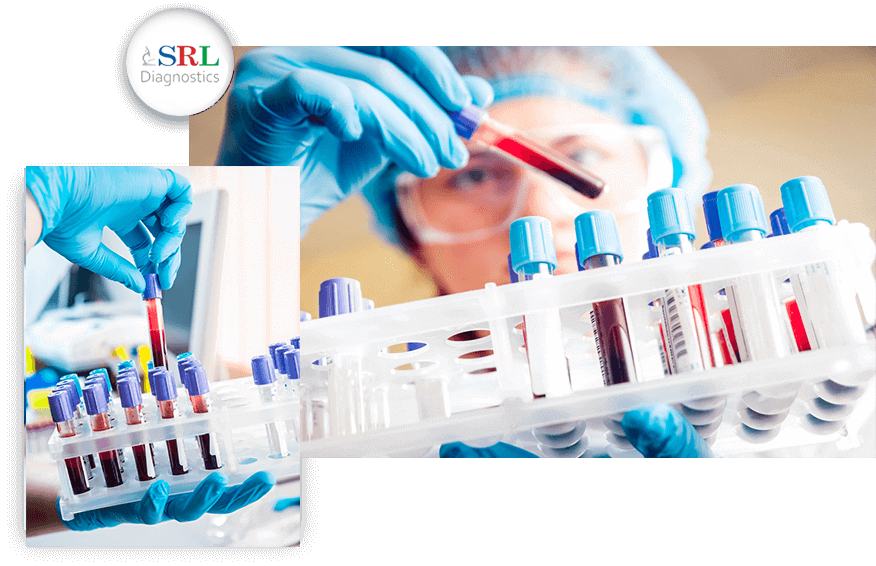 Your SRL Diagnostics comes closer to you. | Pathology lab, Personal health,  Health tests